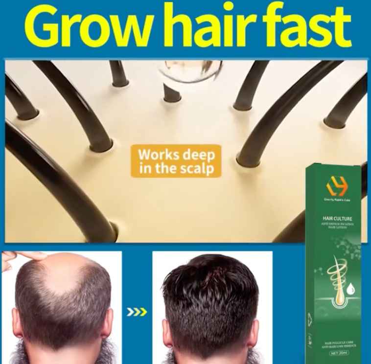 Hair Loss Growth Oil